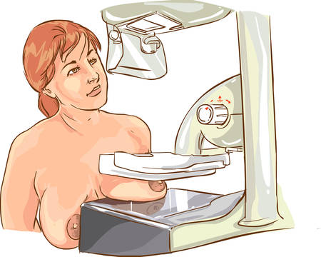 Woman undergoing mammography test control. Isolated on white.のイラスト素材