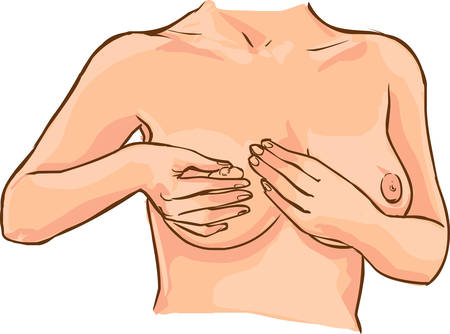 vector illustration of a Breast cancer examinationのイラスト素材