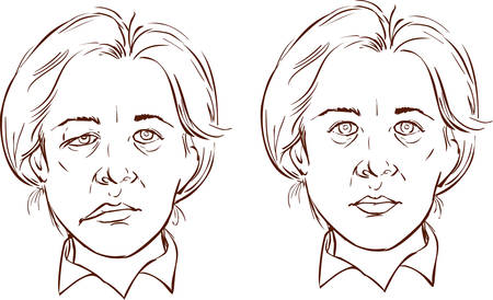 white background vector illustration of a  facial lopsided illustrationのイラスト素材