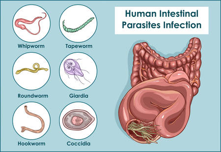 Vector Illustration of a Human Intestinal Parasitesのイラスト素材