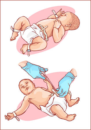 Cutting of the umbilical cord on a newborn babyのイラスト素材