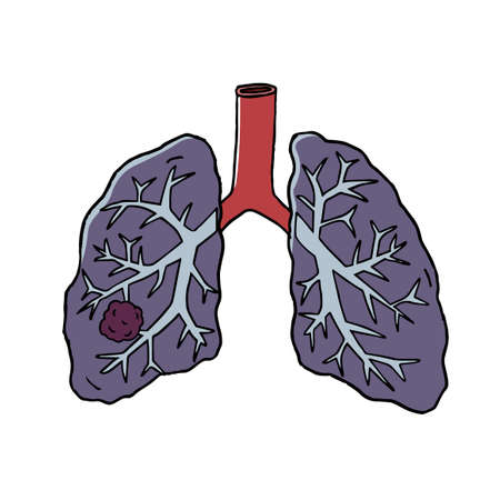 Images of lung cancerのイラスト素材