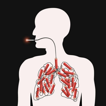 Smoke kills poster, metaphorical depiction of dangers of smoking where lighted cigarette continues as a fuse to dynamite in the lungs of a human figure, quite smoking conceptのイラスト素材