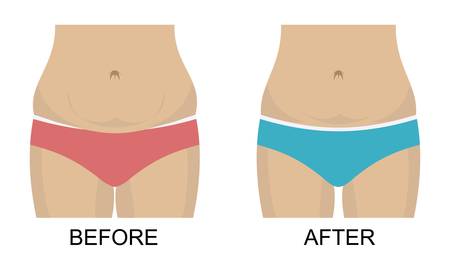 before after concept, weight loss, waist and bellyのイラスト素材