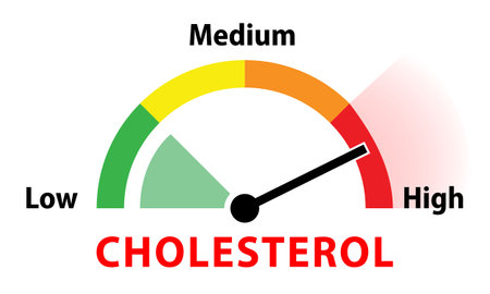 Vector illustration of a meter showing the maximum level of cholesterol in bloodのイラスト素材