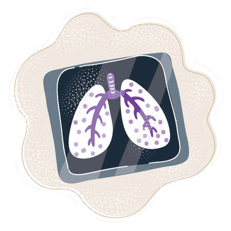 Vector illustration of X-ray of chest.