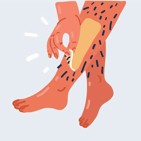 Cartoon vector illustration of woman applying wax to remove hair on her legs. Epilation or sugaring...
