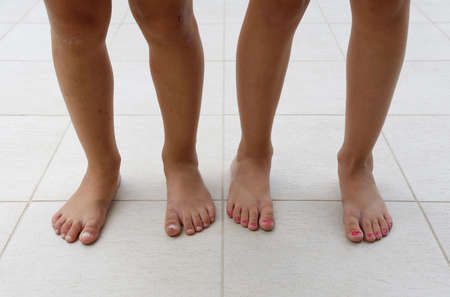 summer kids boy and girl legs differenceの写真素材
