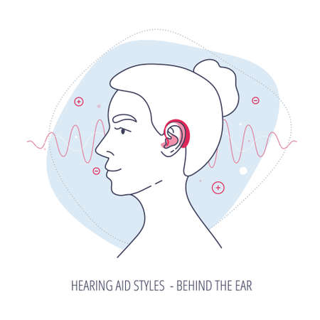 Womans head with behind the ear aid style for the hearing impaired with sound wave, abstract elements on the backgroundのイラスト素材