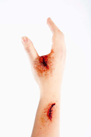 Artificial Blood Wound on Human Hand - Isolated on Whiteの写真素材