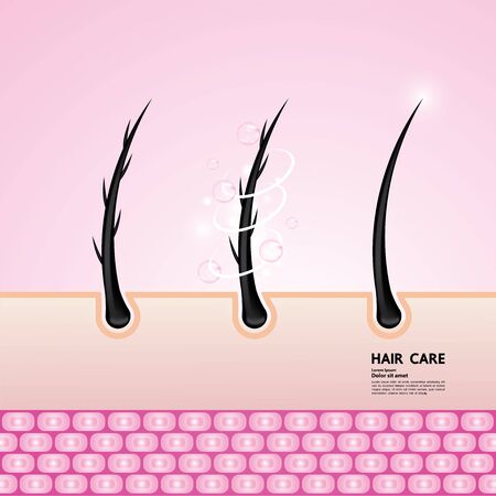 Hair problem and hair protect and care technology concept vector illustration.のイラスト素材