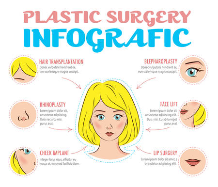 Cosmetic plastic surgery infographics. Rhinoplasty, face lifting, blepharoplasty, eye and lip surgery, hair transplantation, cheek implants. Beauty care concept. Vector poster with elements and icons.のイラスト素材