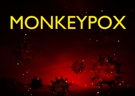 Illustration of monkeypox, infectious disease caused by the monkey pox virus. Multi-country outbreak, the new cases. Viral zoonotic disease, dangerous infectionの写真素材