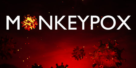 Illustration of monkeypox, infectious disease caused by the monkey pox virus. Multi-country outbreak, the new cases. Viral zoonotic disease, dangerous infection.の写真素材