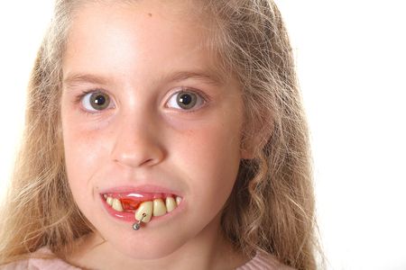 pretty little girl with ugly teeth (copy space right)の写真素材