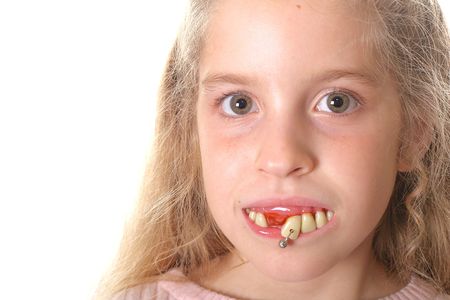 pretty little girl with ugly teeth (copy space left)の写真素材
