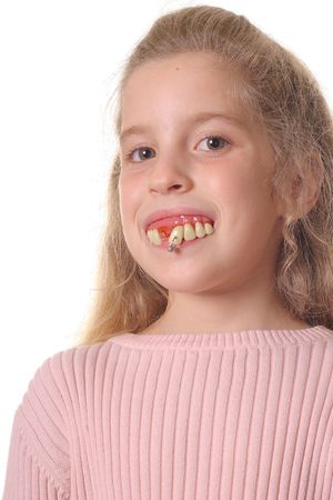 pretty little girl with ugly teeth verticalの写真素材