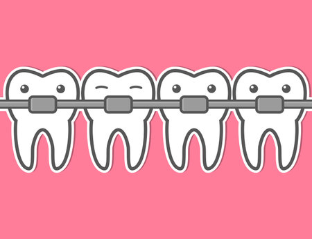 Cartoon teeth braces. Funny dental vector illustration