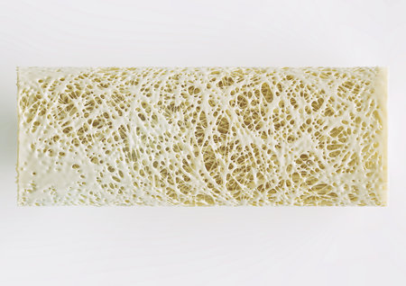Cross section of an advanced osteoporosis -high details - Stage 4 - 3d renderingの写真素材