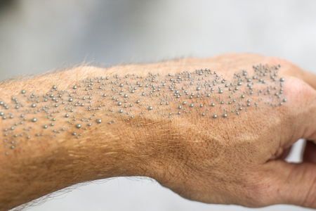 Nanoparticles made visible on human skin -- 3D Renderingの写真素材