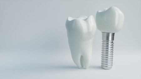 Tooth human implant - 3D Rendering