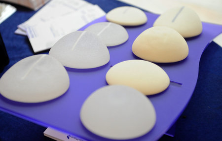 Silicone gel breast implants exposed