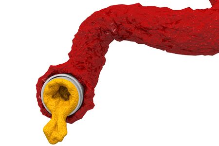 Artery blocked with cholesterol.3d renderの写真素材