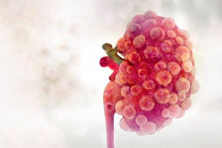 Kidney disease. 3d illustrationの写真素材