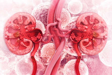 Kidney disease cross section.3d illustrationの写真素材