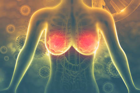 Breast cancer. 3d illustrationの写真素材