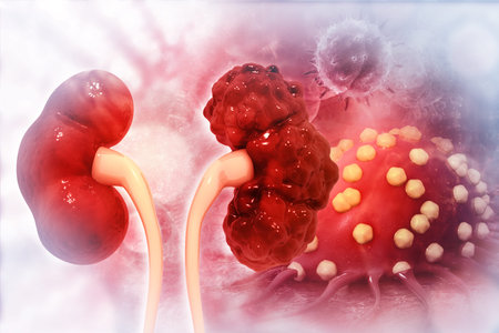 Kidney disease. 3d illustration