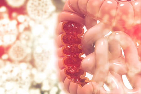 Colon cancer. Colon disease concept. 3d illustration