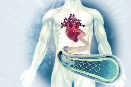 Stent angioplasty on scientific background. 3d illustration