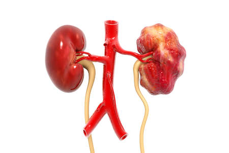 Human kidney on white background. 3d renderの写真素材