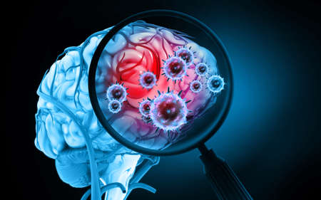 Brain viral infection on science background. 3d illustrationの写真素材