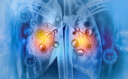 Virus and bacteria infected the Human lungs. lung disease.3d illustrationの写真素材