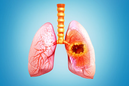 Lung cancer, lung disease, symptoms, stages, treatment, 3d illustrationの写真素材