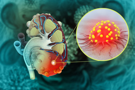 Human polycystic kidney disease. 3d illustrationの素材