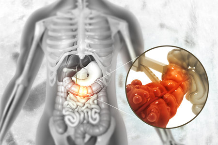 Laparoscopic appendix surgery. 3d illustrationの写真素材