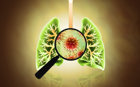 Virus and bacteria infected the Human lungs.lung disease.3d illustrationの写真素材