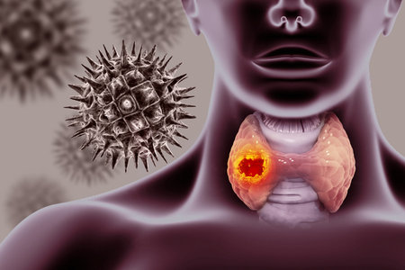Thyroid gland cancer. showing thyroid gland with tumor. 3d illustration