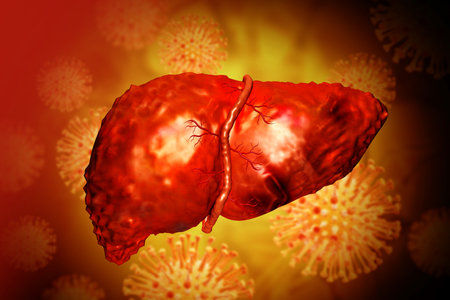 Hepatitis virus with human liver on medical background. 3d illustrationの写真素材
