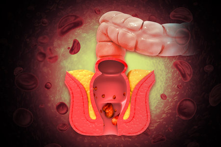 Haemorrhoids (piles) on scientific background, treatment, medicine, 3d illustrationの写真素材