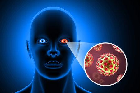 Visual concept of Bacterial conjunctivitis. 3d illustrationの写真素材