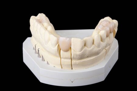 detail dental wax model ower black backgroundの写真素材