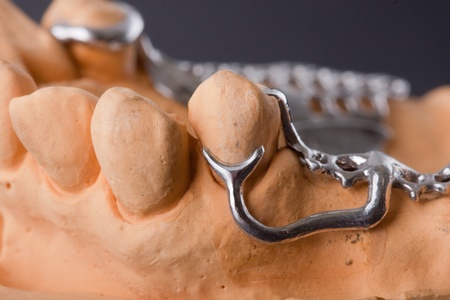 dental wax model ower black backgroundの写真素材