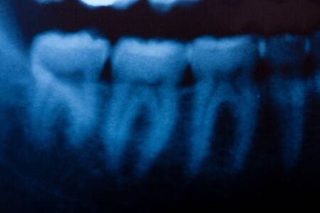 a dental x-ray detailの写真素材