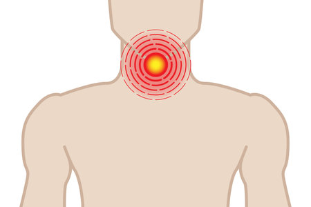 Sore Throat Illustration with Man on White Backgroundのイラスト素材