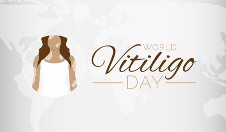Light World Vitiligo Day Background Illustrationのイラスト素材