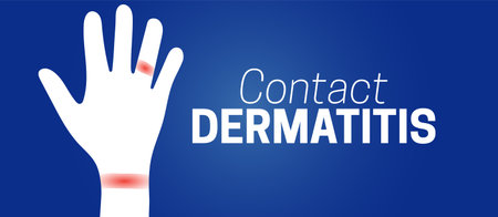 Contact Dermatitis Background Illustration with Hand with Irritationsのイラスト素材